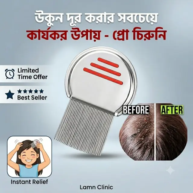 স্টেইনলেস স্টিলের উকুন অপসারণের চিরুনি, Stainless Steel Lice Removal Comb