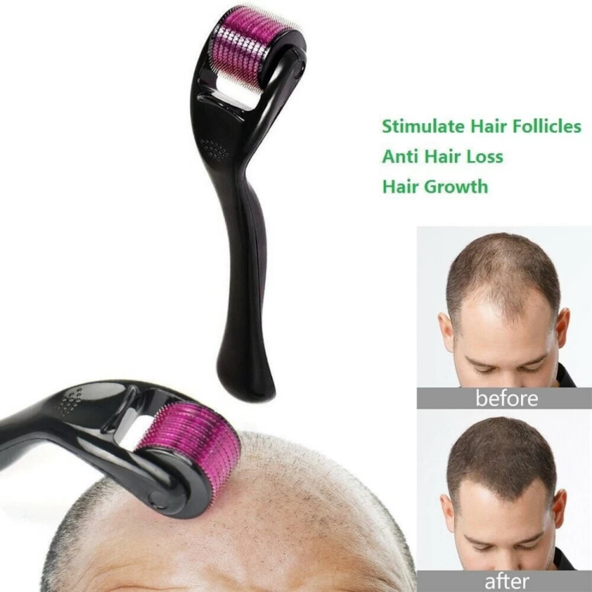 Derma Roller System For Face & Body 0.50mm 540 Needles Derma Roller 3