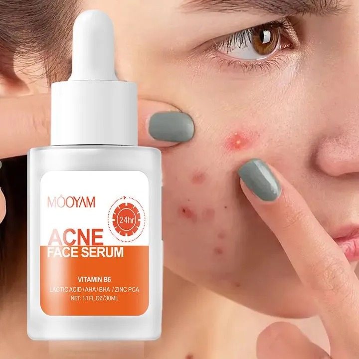 MOOYAM Acne Face Serum / ব্রণ কন্ট্রোল ফেস সিরাম 6